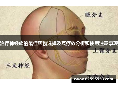 治疗神经痛的最佳药物选择及其疗效分析和使用注意事项